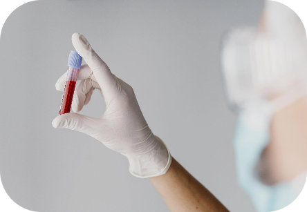 Blood Tests
